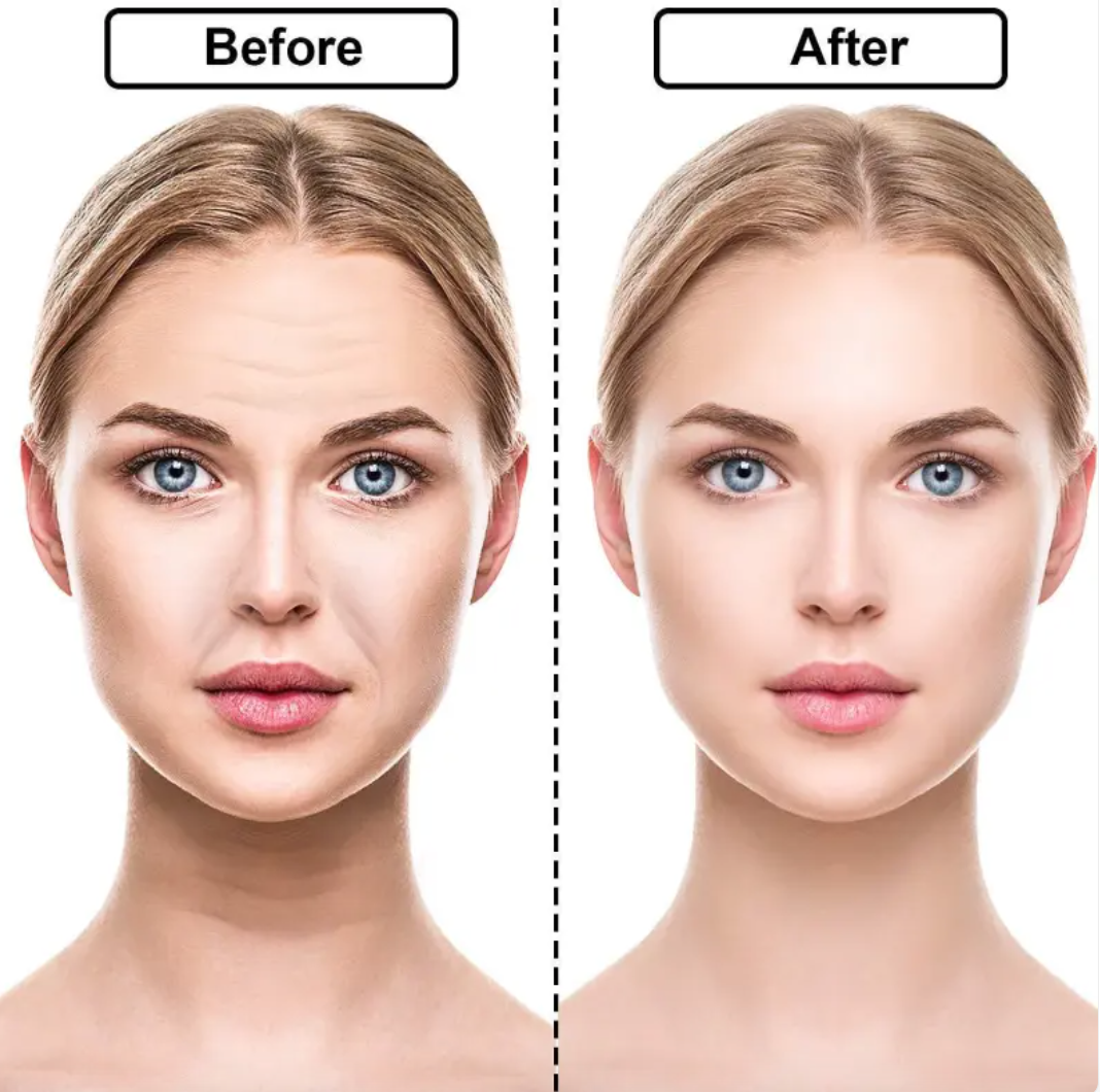 Reusable silicone face patches, set of 11 – view 3