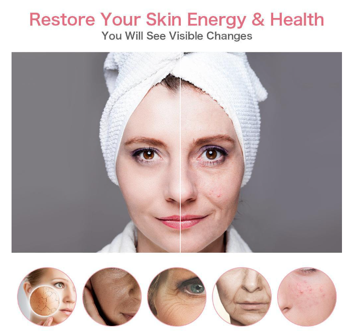 Handheld microcurrent facial beauty device – view 2